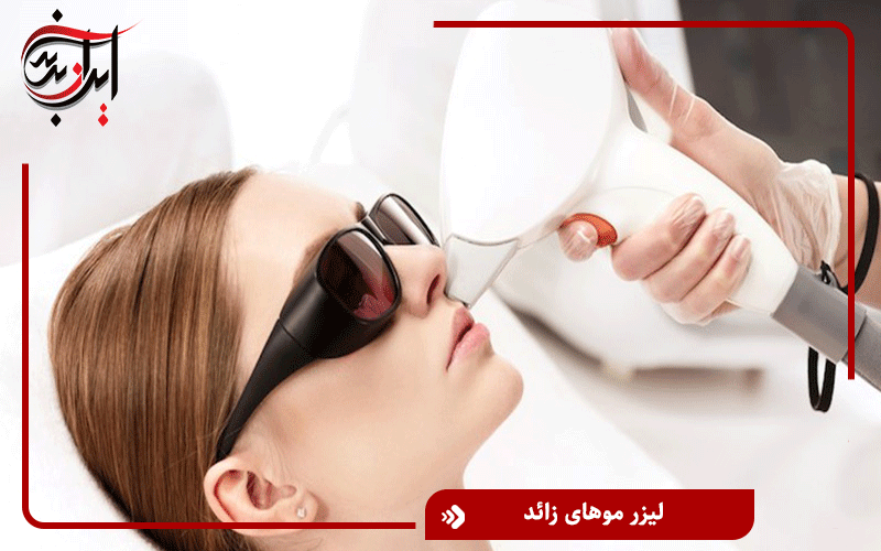 لیزر موهای زائد در تهران