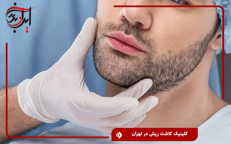 کلینیک کاشت ریش در تهران