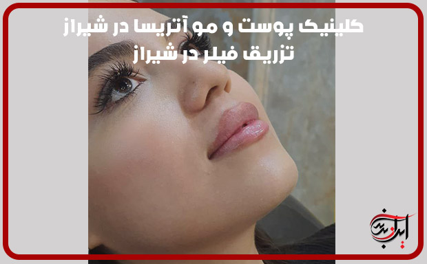 کیلنیک-پوست-و-مو-اتریسا-در-عفیف-اباد-شیراز-تزریق-فیلر-لب
